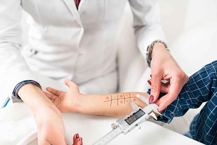 alergia a los arandanos