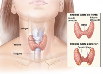 Hipotiroidismo: causas, síntomas y tratamiento.