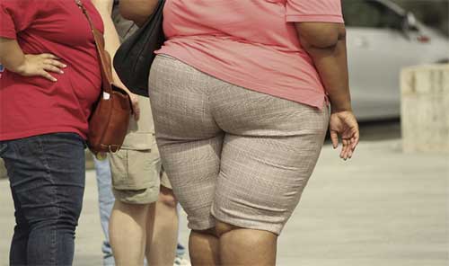 La obesidad, la terrible pandemia invisible del siglo XXI